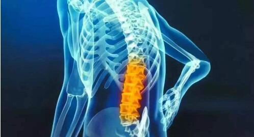 腰肌劳损是什么原因导致的